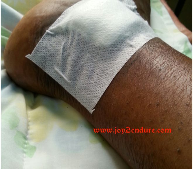 SickleCell Awareness: Dealing With Leg Ulcers; Lessons From My Fourth Hospital Marathon.